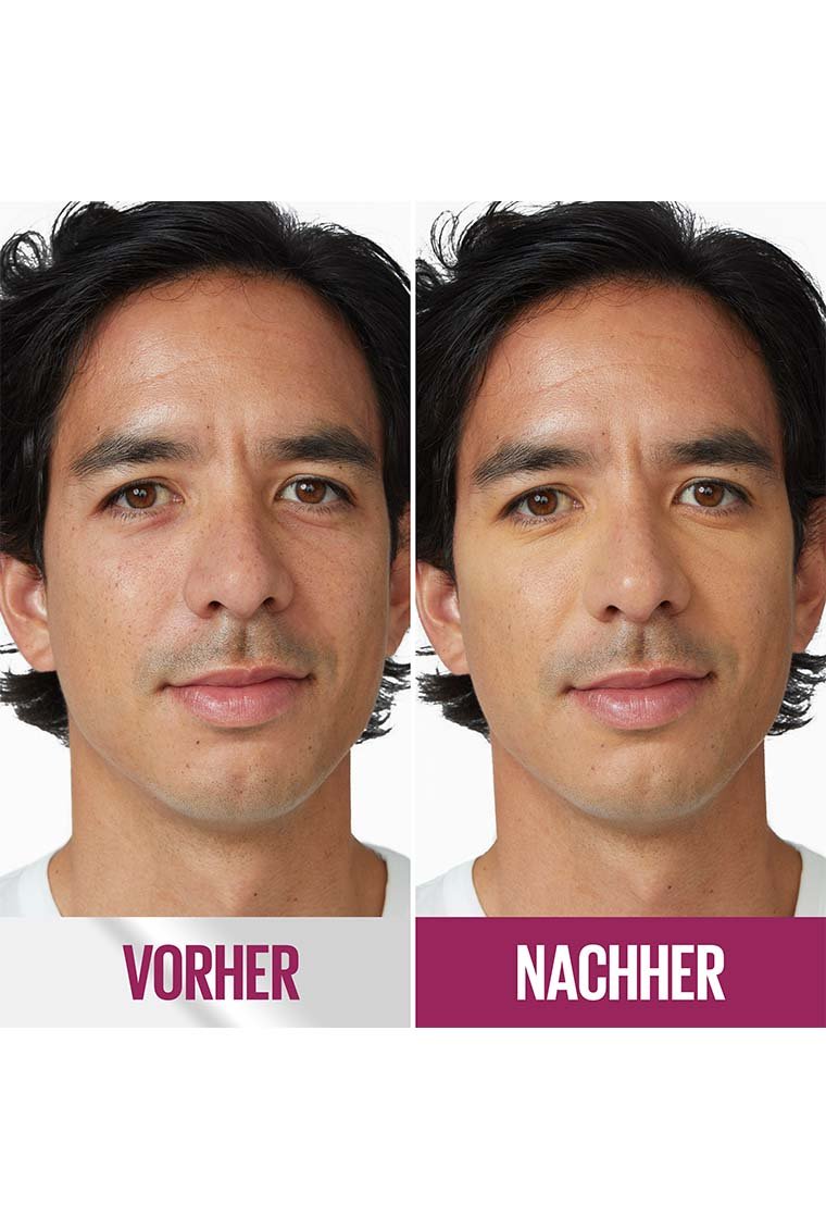 vorher nachher